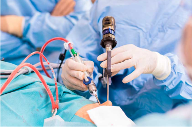 Gurgaon ENT Centre, Best ENT Surgery Centre in Gurgaon India, Best ENT Care Centre in India